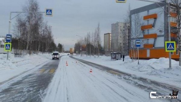 В Югре на пешеходном переходе сбили подростка. Мальчик получил травмы