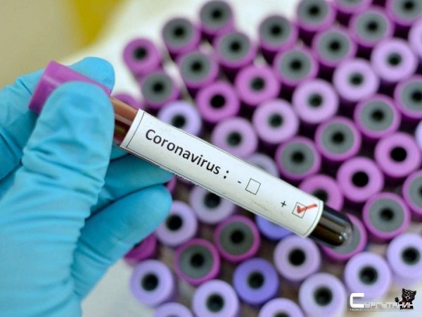 16 зараженных. В Югре увеличилось количество заболевших коронавирусом