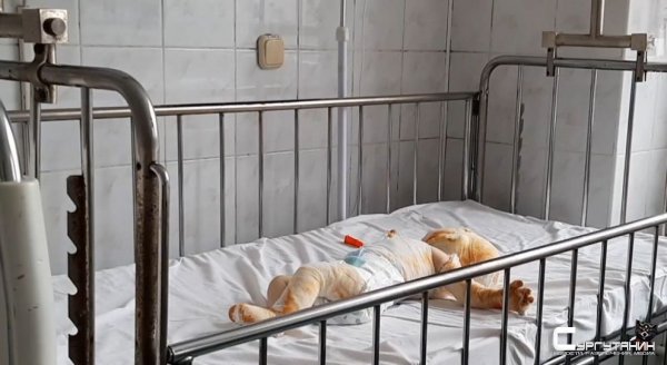 Родители игнорировали ожоги восьмимесячного сына, пока он не умер