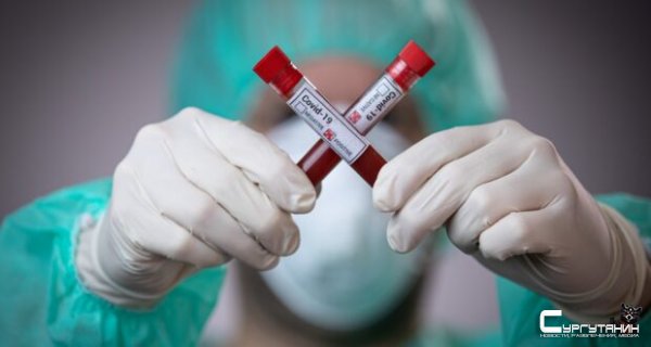 Число ежедневно выявляемых случаев COVID в Югре по-прежнему за 140