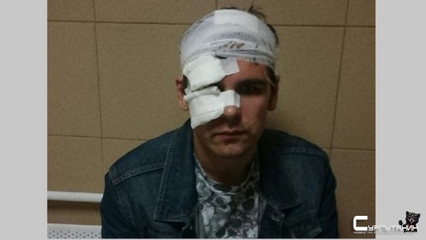 В Сургуте трое отморозков избили уличного музыканта
