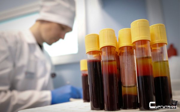 В Югре снижается число больных ВИЧ-инфекцией и наркоманией